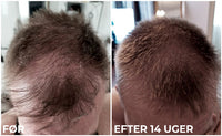 Sanzi - Hair Growth & Enhancing Serum + Micro Needle Roller