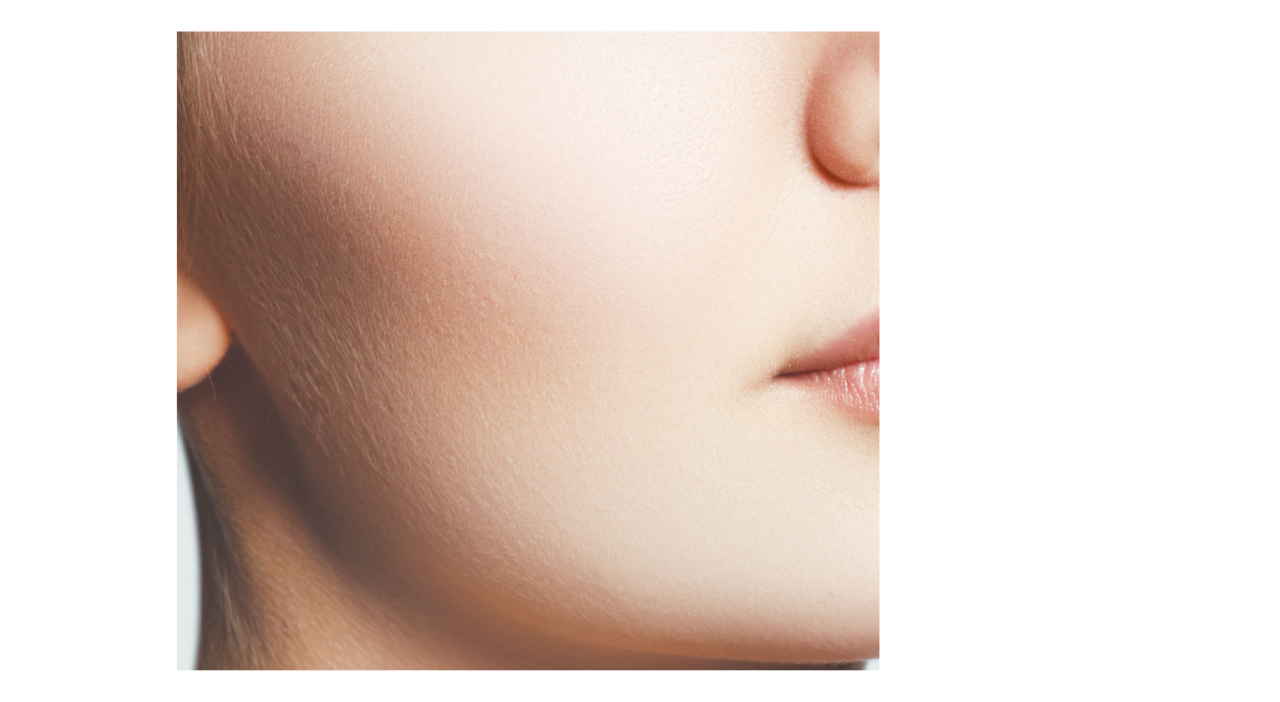 Fillerina 12HA - Specific Zones Cheekbones (Grade 5)