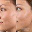 SANZI BEAUTY - BHA & PHA Serum