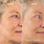 SANZI BEAUTY - WEEKLY PEEL WITH 28% AHA & 2% BHA