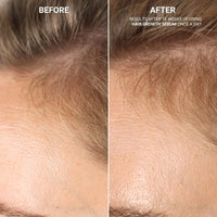 HAIR GROWTH SERUM WITH SANZI GROWTH COMPLEX™ (120ML)