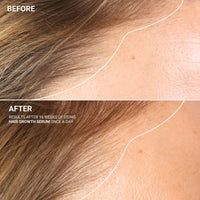 HAIR GROWTH SERUM WITH SANZI GROWTH COMPLEX™ (120ML)