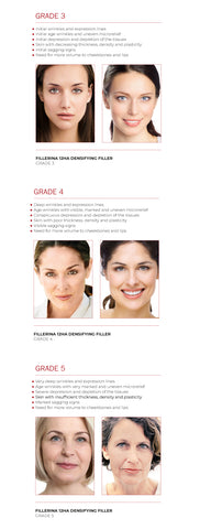 FILLERINA 12 - CHEEKBONES (GRADE 4)