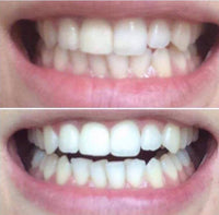 Sanzi Beauty - Charcoal Teeth Whitening 30g