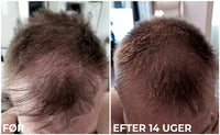 Sanzi - Hair Growth & Enhancing Serum