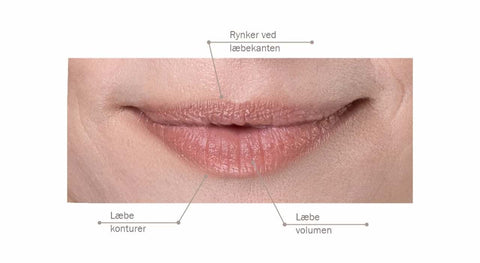 Fillerina 12HA - Specific Zones Lips & Mouth (Grade 5)